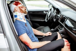Car Accident Injuries And How They Affect Compensation