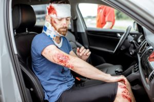 Common Types Of Personal Injuries Sustained In Car Accidents